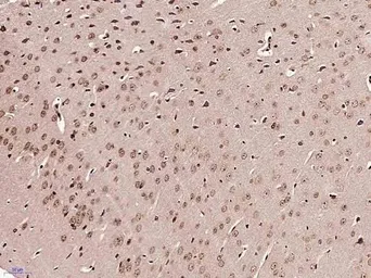 Anti-FOXJ1 antibody used in IHC (Paraffin sections) (IHC-P). GTX37424
