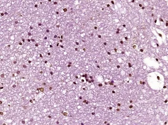 Anti-FOXJ1 antibody used in IHC (Paraffin sections) (IHC-P). GTX37424