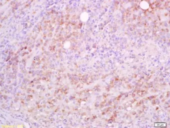 Anti-CD5L antibody used in IHC (Paraffin sections) (IHC-P). GTX37448