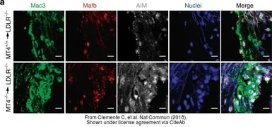 Anti-CD5L antibody used in Immunohistochemistry (IHC). GTX37448