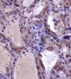 Anti-NIS antibody used in IHC (Paraffin sections) (IHC-P). GTX37599