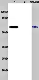 Anti-NIS antibody used in Western Blot (WB). GTX37599