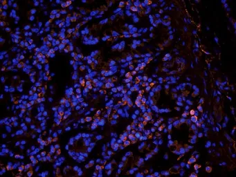 Anti-Leptin Receptor antibody used in IHC (Frozen sections) (IHC-Fr). GTX37636