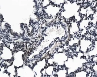 Anti-KGF antibody used in IHC (Paraffin sections) (IHC-P). GTX37698