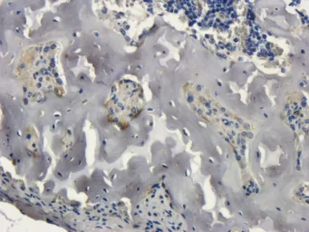 Anti-Collagen X antibody used in IHC (Paraffin sections) (IHC-P). GTX37732