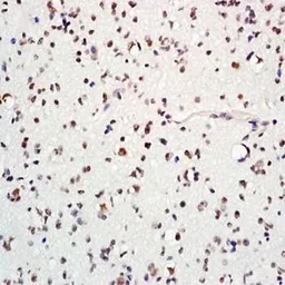 Anti-ASCL1 antibody used in IHC (Paraffin sections) (IHC-P). GTX37779