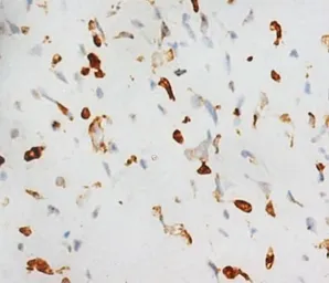 Anti-RUNX2 antibody used in IHC (Paraffin sections) (IHC-P). GTX38531