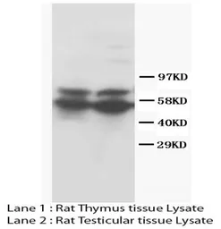 Anti-RUNX2 antibody used in Western Blot (WB). GTX38531