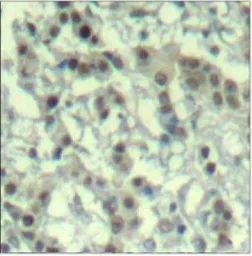 Anti-Aurora A (phospho Thr288) antibody used in IHC (Paraffin sections) (IHC-P). GTX38590