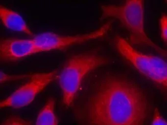 Anti-PKC mu (phospho Ser738) antibody used in Immunocytochemistry/ Immunofluorescence (ICC/IF). GTX38607