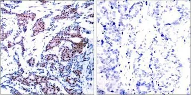 Anti-c-Jun (phospho Ser73) antibody used in IHC (Paraffin sections) (IHC-P). GTX38608