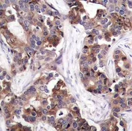 Anti-Stathmin 1 (phospho Ser25) antibody used in IHC (Paraffin sections) (IHC-P). GTX38657