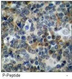 Anti-VASP (phospho Ser239) antibody used in IHC (Paraffin sections) (IHC-P). GTX38661