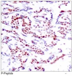 Anti-ATF2 (phospho Ser112) antibody used in IHC (Paraffin sections) (IHC-P). GTX38683