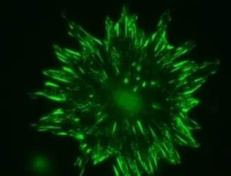 Anti-Talin-2 antibody [53.8] used in Immunocytochemistry/ Immunofluorescence (ICC/IF). GTX38970