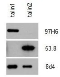 Anti-Talin-2 antibody [53.8] used in Western Blot (WB). GTX38970