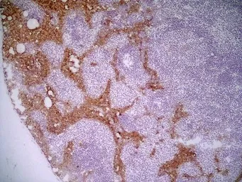 Anti-Marco antibody [ED31] used in IHC (Frozen sections) (IHC-Fr). GTX39743