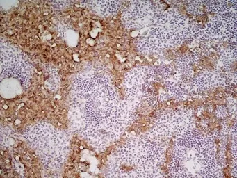 Anti-Marco antibody [ED31] used in IHC (Frozen sections) (IHC-Fr). GTX39743