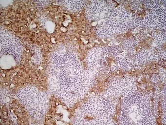 Anti-Marco antibody [ED31] used in IHC (Frozen sections) (IHC-Fr). GTX39744