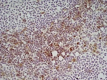 Anti-Ly6c antibody [ER-MP20] used in IHC (Frozen sections) (IHC-Fr). GTX39791