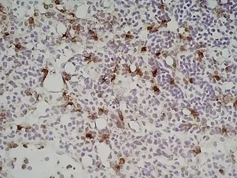 Anti-Ly-6B.2 antibody [7/4] used in IHC (Frozen sections) (IHC-Fr). GTX39793