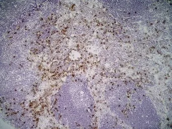 Anti-Ly-6B.2 antibody [7/4] used in IHC (Frozen sections) (IHC-Fr). GTX39793