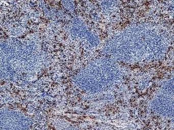 Anti-Ly-6B.2 antibody [7/4] used in IHC (Frozen sections) (IHC-Fr). GTX39795