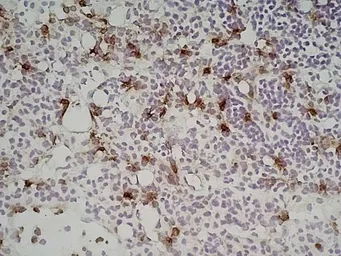 Anti-Ly-6B.2 antibody [7/4] used in IHC (Frozen sections) (IHC-Fr). GTX39795