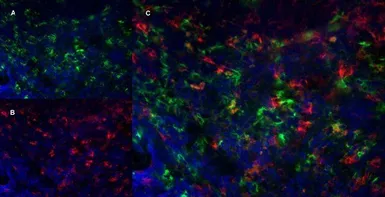 Anti-Ly-6B.2 antibody [7/4] (Low endotoxin, azide free) used in IHC (Frozen sections) (IHC-Fr). GTX39796