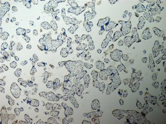 Anti-Inhibin alpha antibody [R1] used in IHC (Paraffin sections) (IHC-P). GTX40215