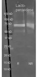 Anti-Lactoperoxidase antibody (HRP) used in Western Blot (WB). GTX40571