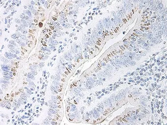 Anti-CXCL2 / GRO beta antibody used in IHC (Paraffin sections) (IHC-P). GTX40895