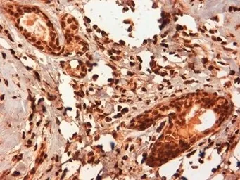 Anti-Estrogen Receptor beta 5 antibody [5/25] used in IHC (Paraffin sections) (IHC-P). GTX41209