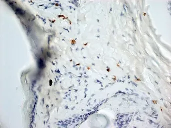 Anti-Dectin-1 antibody [2A11] used in IHC (Frozen sections) (IHC-Fr). GTX41467
