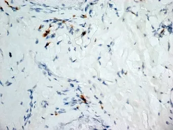 Anti-Dectin-1 antibody [2A11] used in IHC (Frozen sections) (IHC-Fr). GTX41473