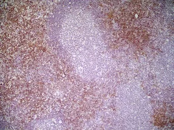 Anti-CD8 antibody [YTS169.4] used in IHC (Frozen sections) (IHC-Fr). GTX41818
