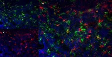 Anti-CD8 alpha antibody [YTS105.18] (Low endotoxin, azide free) used in IHC (Frozen sections) (IHC-Fr). GTX41819