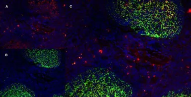 Anti-CD70 antibody [Bu69] used in IHC (Frozen sections) (IHC-Fr). GTX41860