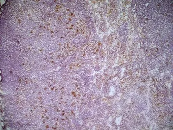 Anti-CD68 antibody [FA-11] used in IHC (Frozen sections) (IHC-Fr). GTX41865