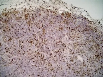 Anti-CD68 antibody [ED1] used in IHC (Frozen sections) (IHC-Fr). GTX41868