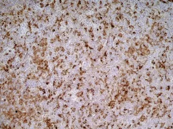 Anti-CD68 antibody [ED1] used in IHC (Frozen sections) (IHC-Fr). GTX41868