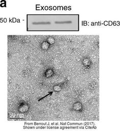 Anti-CD63 antibody [AD1] used in Western Blot (WB). GTX41877