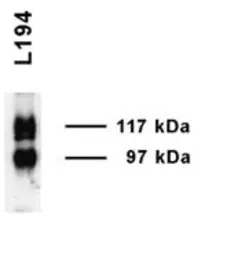 Anti-UT-A1 antibody used in Western Blot (WB). GTX41973