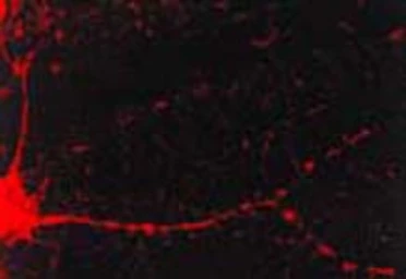 Anti-CaMKII alpha antibody [6G9] used in Immunohistochemistry (IHC). GTX41976