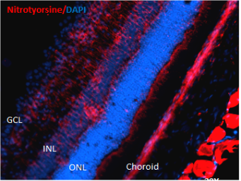 Anti-Nitrotyrosine antibody [39B6] used in Western Blot (WB). GTX41979