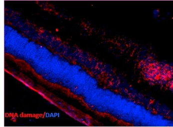 Anti-8-Hydroxyguanosine antibody [15A3] used in IHC (Paraffin sections) (IHC-P). GTX41980