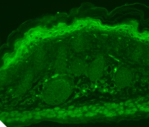 Anti-TRPV3 antibody [S15-4] used in Immunocytochemistry/ Immunofluorescence (ICC/IF). GTX42000