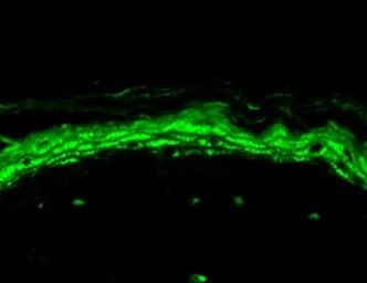 Anti-Nav1.8 antibody [S134-12] used in IHC (Paraffin sections) (IHC-P). GTX42021