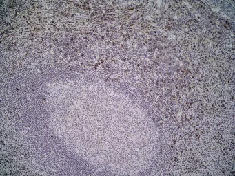 Anti-NKG2D antibody [1D11] used in IHC (Frozen sections) (IHC-Fr). GTX42086