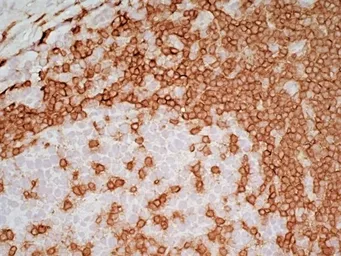 Anti-CD3 epsilon antibody [UCHT1] (Low endotoxin, azide free) used in IHC (Frozen sections) (IHC-Fr). GTX42102
